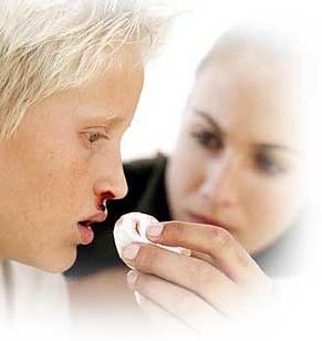 Jak zatrzymać krwawienie z nosa